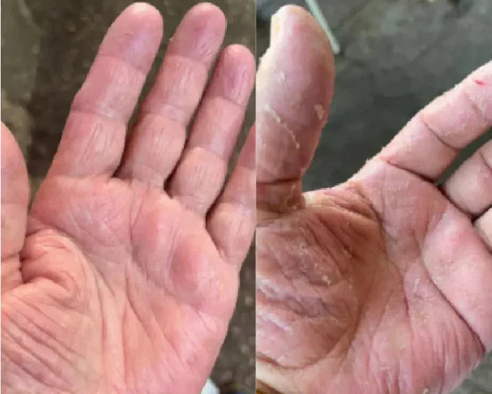 Skin Barrier Repair: How to Fix a Damaged Skin Barrier Fast