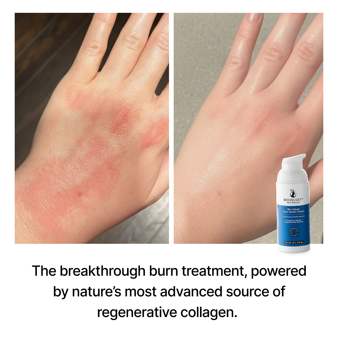 Skin Barrier Repair: How to Fix a Damaged Skin Barrier Fast