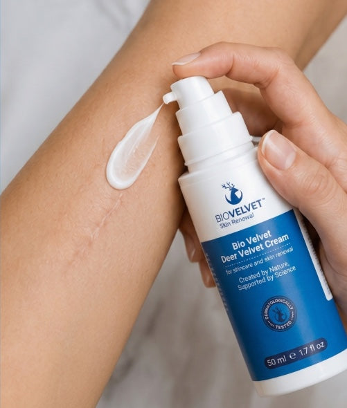 How to Choose the Best Cream for Sensitive Skin