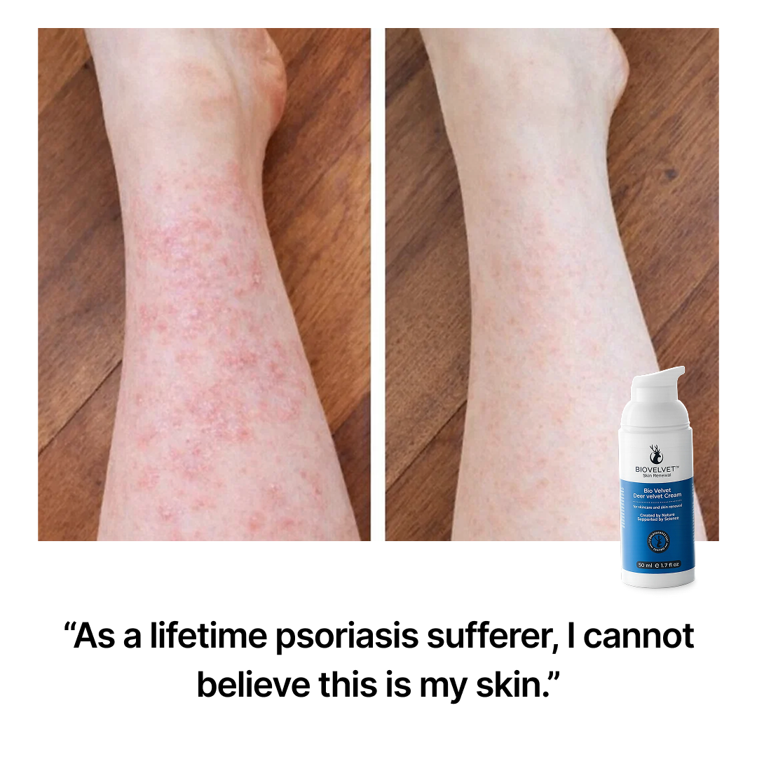 BIOVELVET Recovery Cream