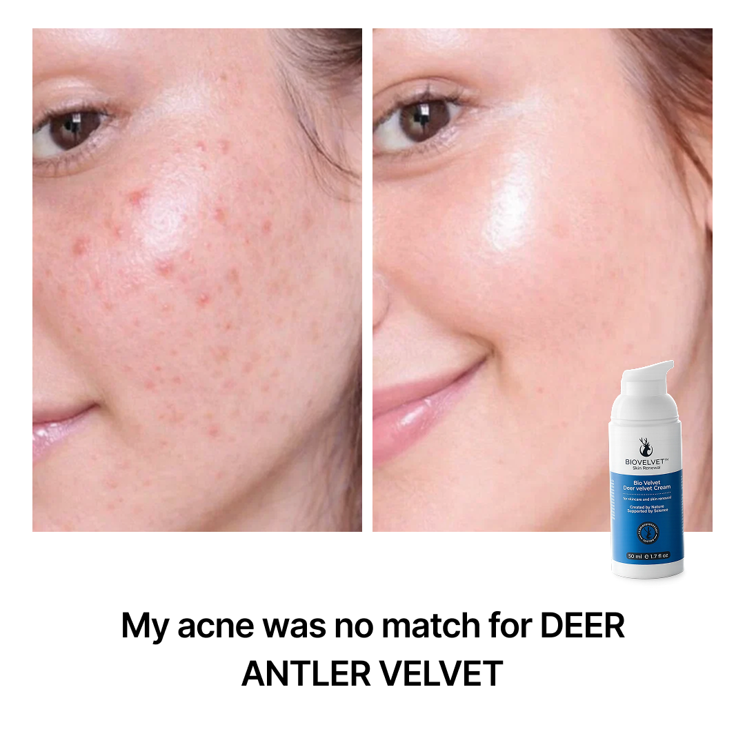 BIOVELVET Recovery Cream